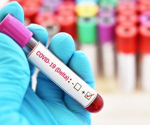  Koronawirus, wtorek 31.08.21 r. Opolskie: Ile dziś zakażeń? [RAPORT]