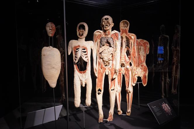 Wystawa z ludzkiego ciała. Body Worlds powróciła do Gdańska po 5 latach 