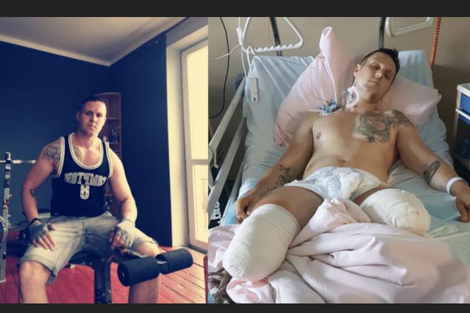 Śląskie: Stracił obie nogi w koszmarnym wypadku, ale chce dalej normalnie żyć. Można mu pomóc