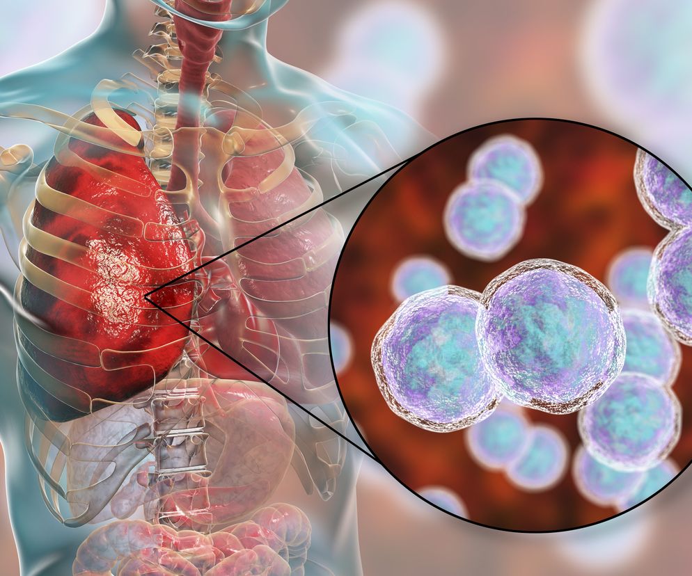 Moraxella catarrhalis