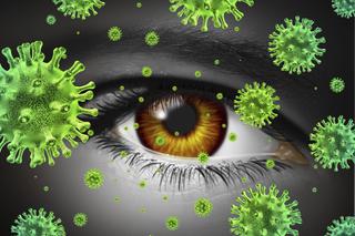 ZAPALENIE SPOJÓWEK wywołane przez bakterie, wirusy lub grzyby
