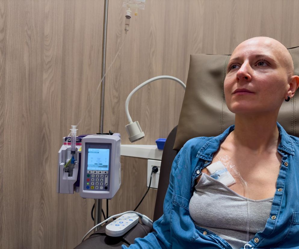 Łysa kobieta otrzymuje chemioterapię, siedząc na brązowym fotelu w jasnym pomieszczeniu. Ma port naczyniowy na klatce piersiowej. Obok niej widoczny jest stojak z kroplówką oraz pompa infuzyjna. Kobieta jest symbolem walki z chorobą, o czym przeczytasz na Poradnik Zdrowie.