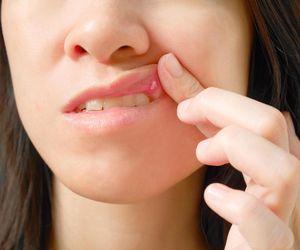 Afty w jamie ustnej – skąd się biorą i jak szybko się ich pozbyć?