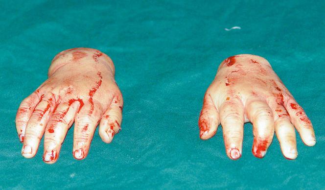 Babcia obcięła wnuczce rączki!