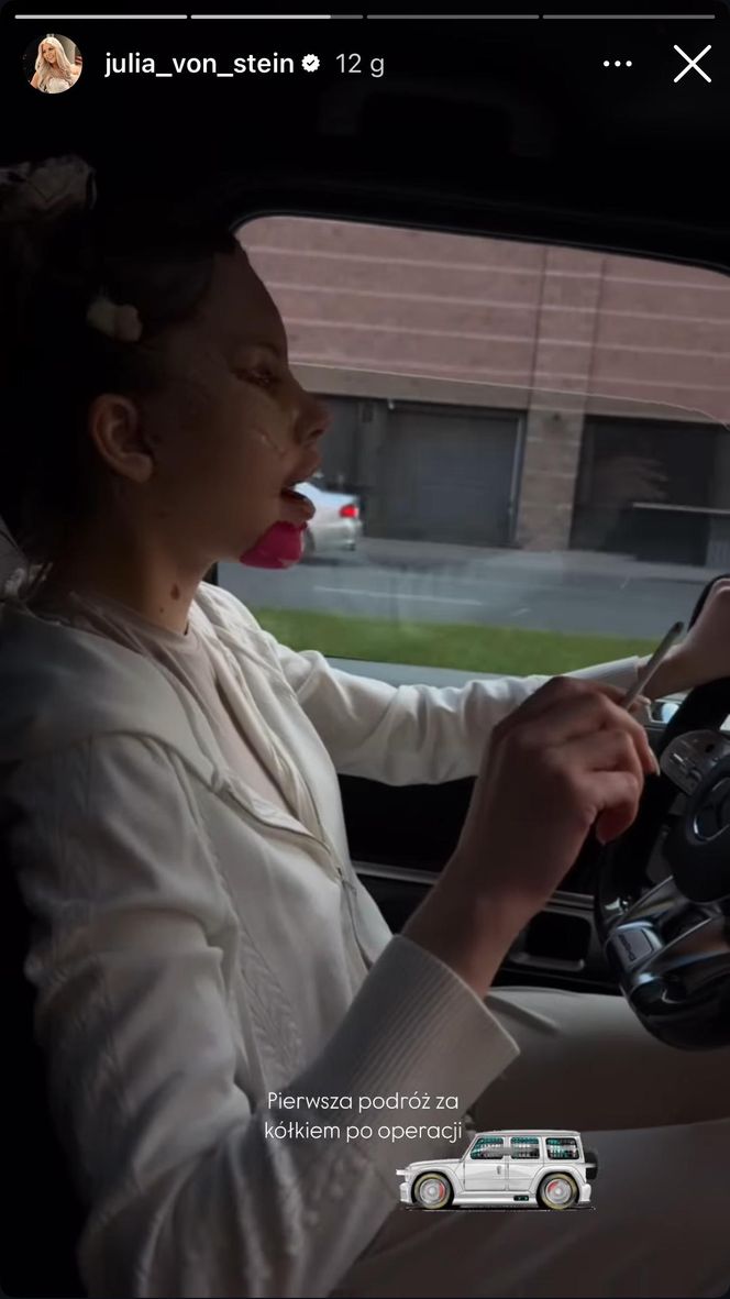 Julia von Stein po operacji