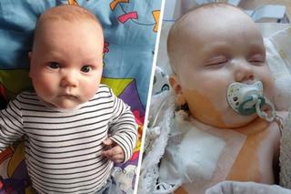 Adaś Krzyżanowski potrzebuje leczenia. Nowotwór zżera jego malutkie oczko