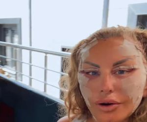 Dagmara Kaźmierska po operacji twarzy