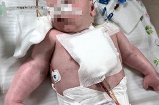 Mały Krzyś ma połowę serduszka, ale rodzice kochają go całym sercem. Ruszyła zbiórka [ZDJĘCIA]