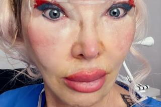 Ewa Minge wycięła powieki