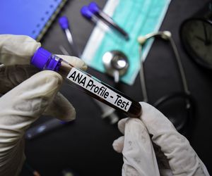 Test diagnostyczny ANA (przeciwciał przeciwjądrowych)