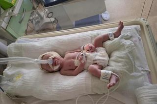 Dzień Wcześniaka w Szpitalu św. Zofii w Warszawie