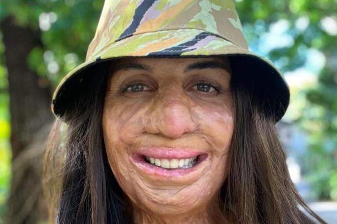 Turia Pitt