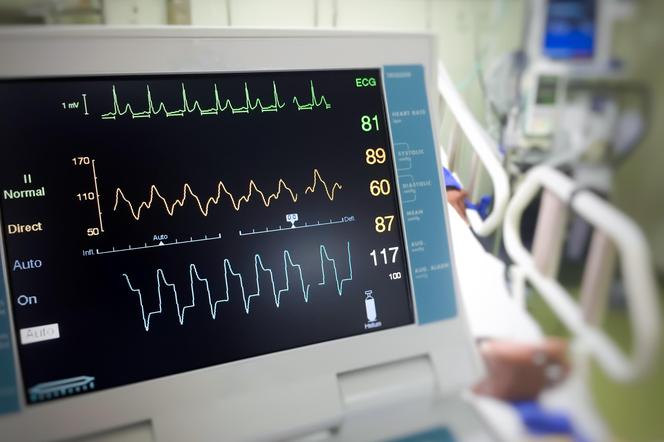 Niewydolność serca co roku zabiera 142 tys. Polaków. Nikt nie jest za młody na tę chorobę