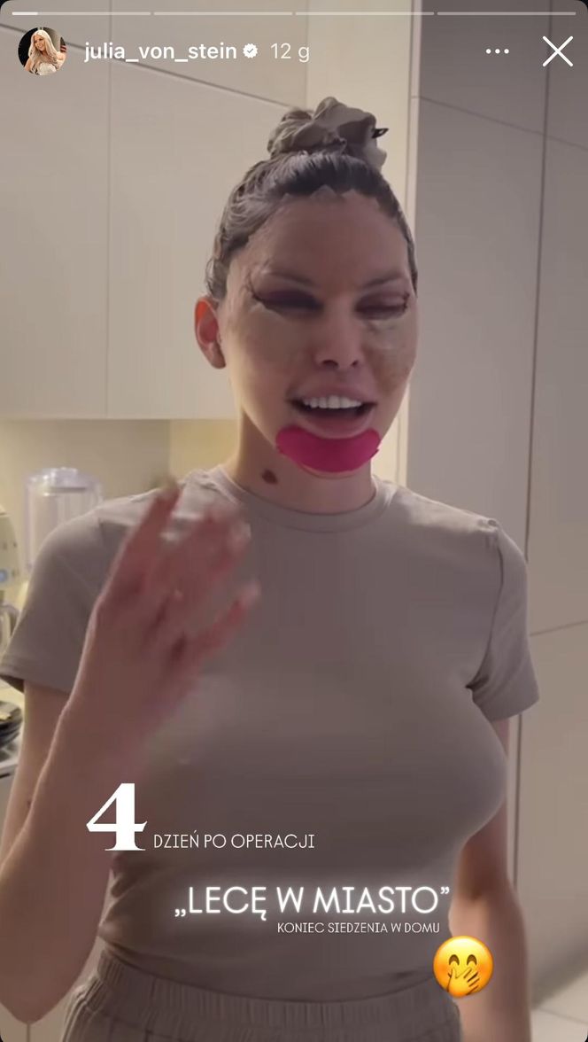 Julia von Stein po operacji