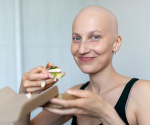 Alopecja mocniej dotyka kobiet. Łysienie plackowate - przyczyny, objawy i leczenie