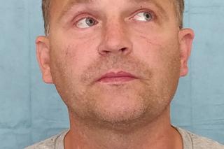 Wydrukowali mu nowe kości twarzy