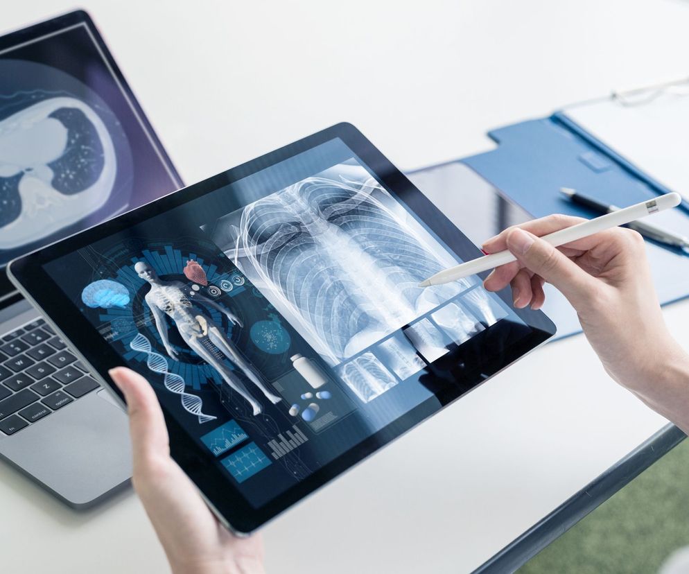 Wiele badań wskazuje, że obraz widoczny w czasie tomografii pomaga zdiagnozować zakażenie koronawirusem.