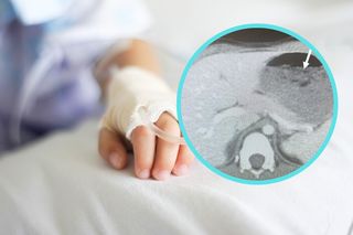 5-latek trafił na SOR z ostrym bólem brzucha. To lekarze znaleźli w jego żołądku