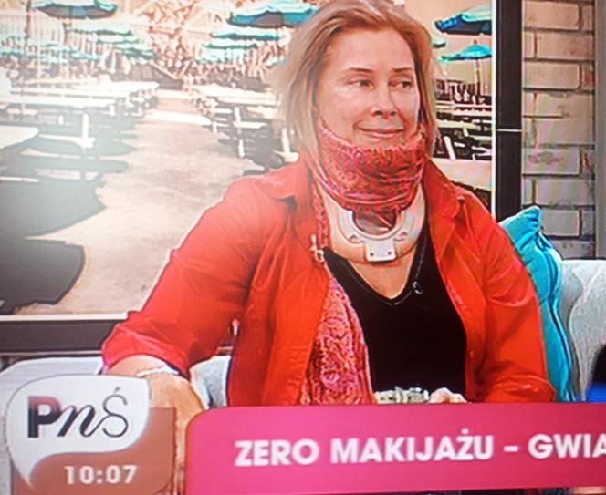 Małgorzata Potocka w kołnierzu ortopedycznym