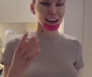 Julia von Stein po operacji