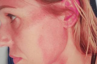 Zofia Klepacka: zostałam pobita