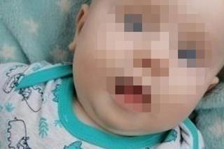 Mały Marcelek z Wyszogrodu walczy o powrót do normalności! Jego mama dowiedziała się o chorobie synka w dniu porodu [ZDJĘCIA]