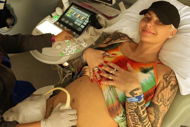 Amber Rose w ciąży