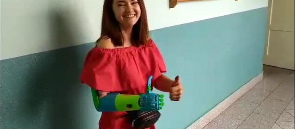 Koledzy wydrukowali Kindze kolejną rękę w 3D