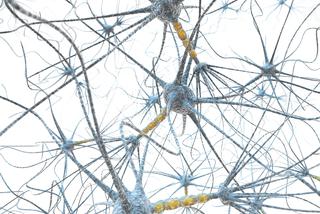 Mononeuropatia to uszkodzenie nerwu, przekazującego informacje z mózgu do innych narządów