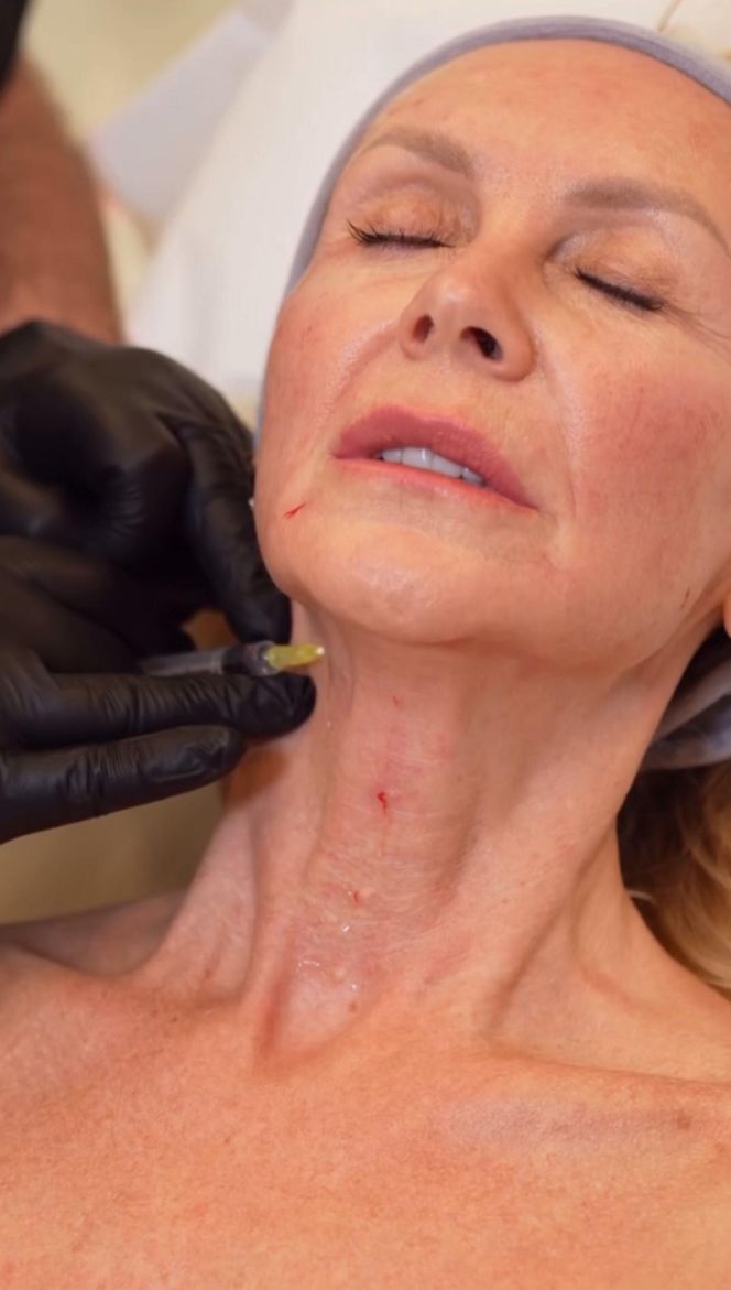 Jenningsowie kontra Alzheimer (BBC Earth)