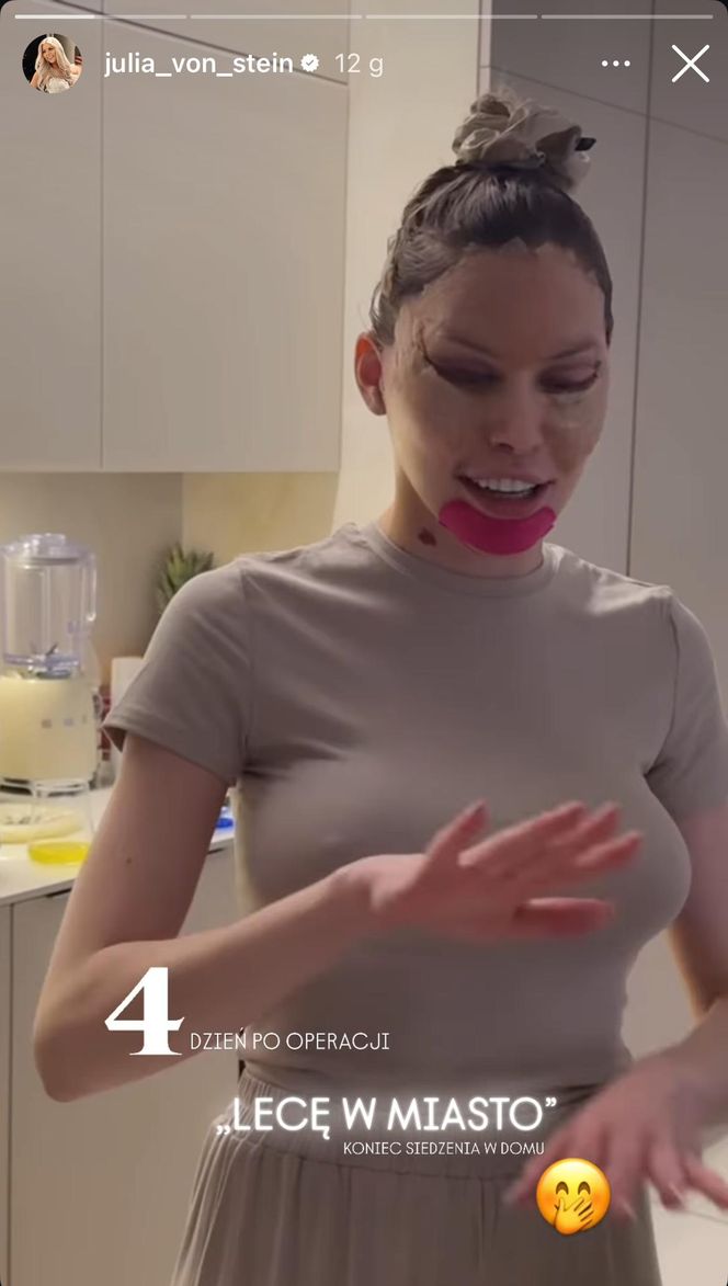 Julia von Stein po operacji