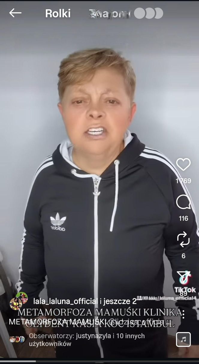 Laluna sprawiła mamie nowe zęby. "Dałaś mi drugie życie"