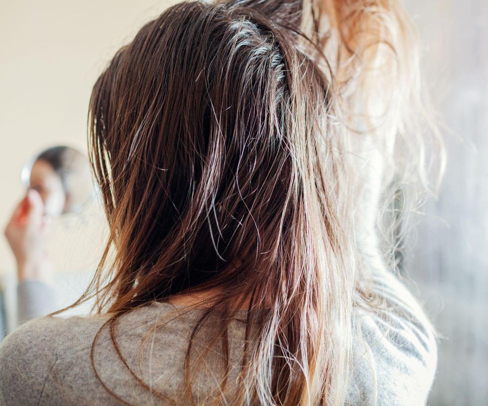 Skuteczny patent na przetłuszczające się włosy. Rozwiąże problem w mgnieniu oka!