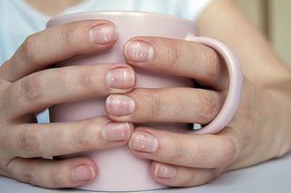 Zauważasz te zmiany na swoich paznokciach? Sprawdź, co mogą oznaczać