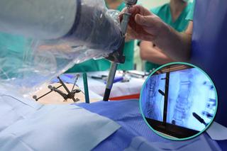 W tym szpitalu padł rekord! Szczecińscy lekarze zoperowali w ten sposób najwięcej kręgosłupów w Polsce
