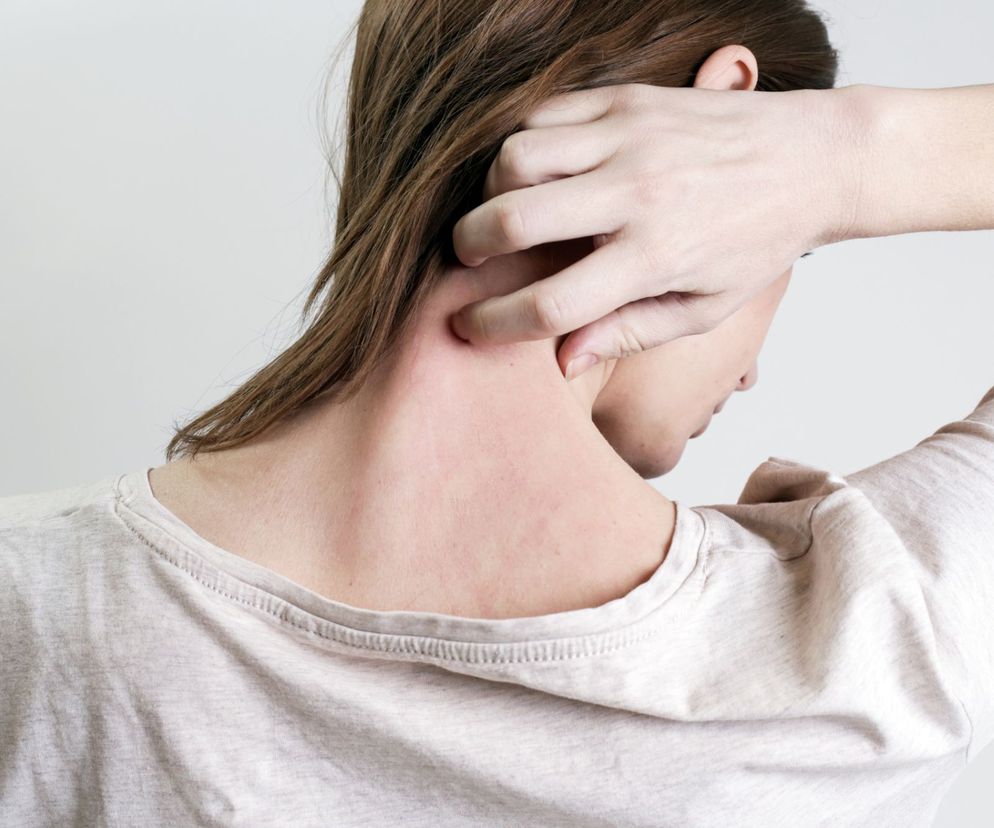 Porada psychodermatologa