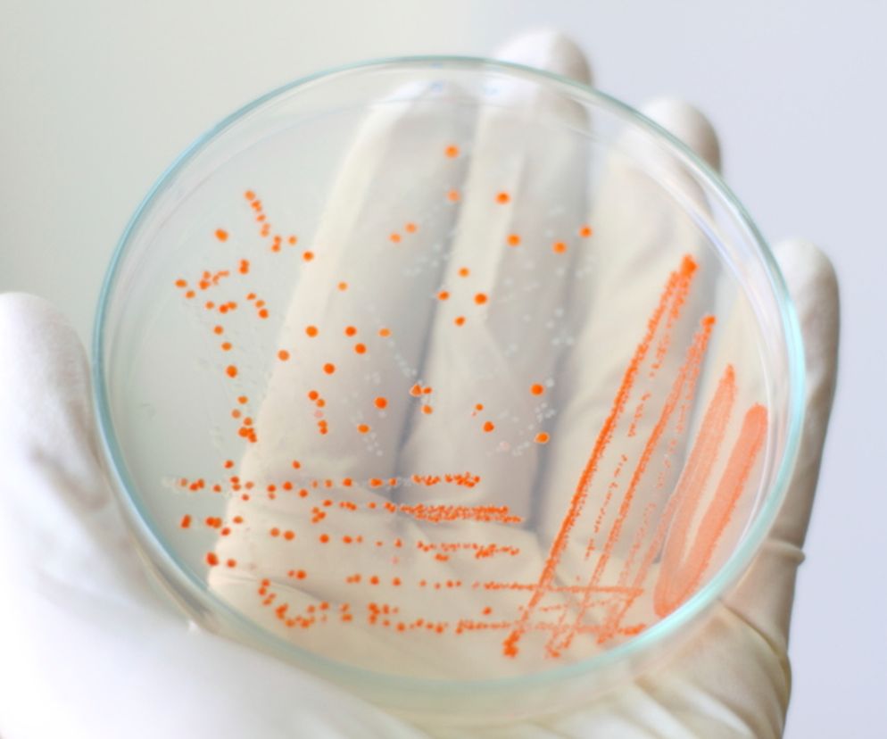 Helicobacter pylori - badania. Testy wykrywające bakterię H. pylori