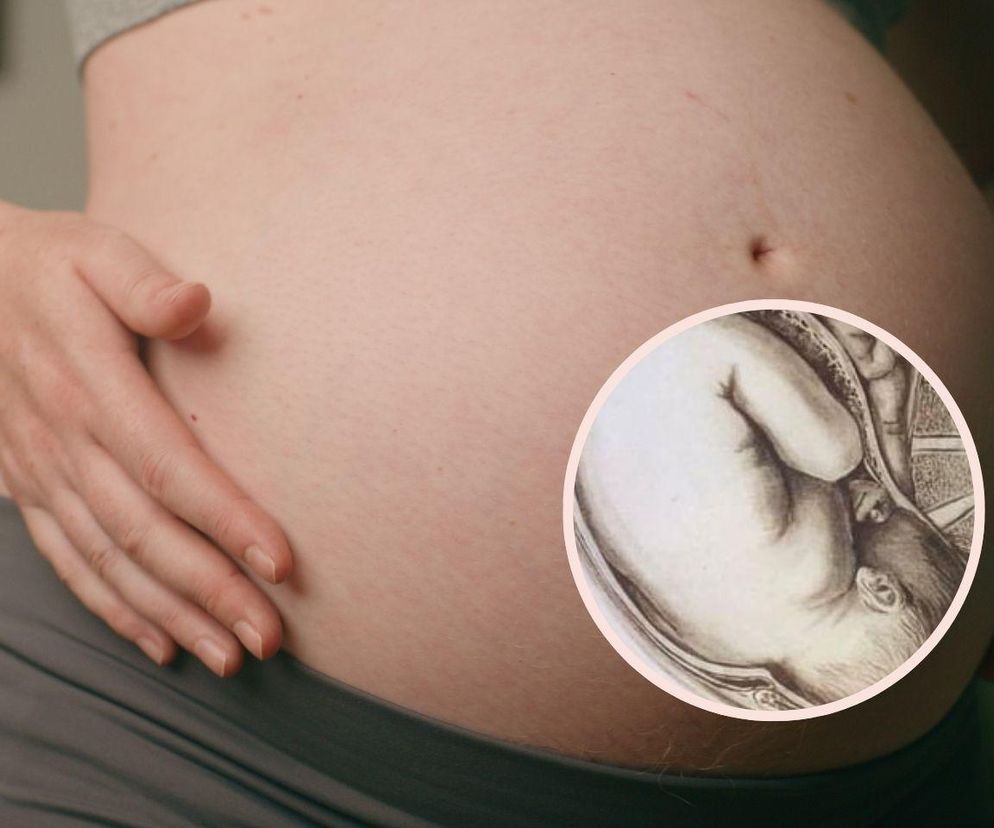 Ciąża to nie choroba? Te zdjęcia dają do myślenia