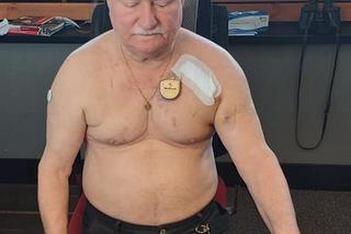 Lech Wałęsa po operacji