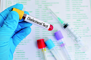 Zapanuj nad cholesterolem - co robić, by utrzymać go w normie