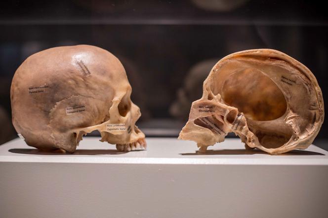 Bodies Revealed