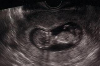 Trzymała płód w lodówce