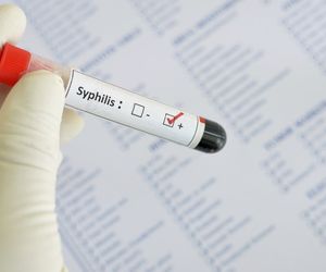 ODCZYN WASSERMANA (WR) - badanie wykorzystywane w diagnostyce kiły