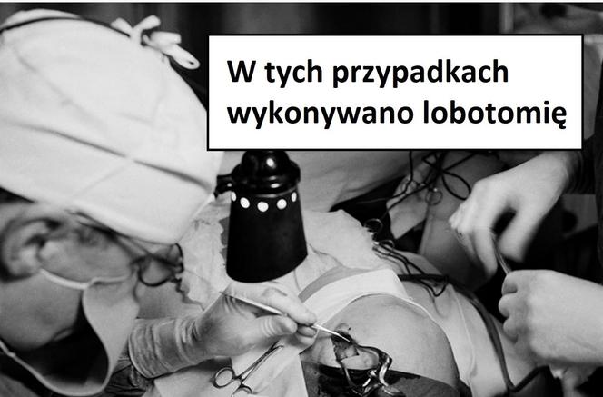 W tych przypadkach stosowano lobotomię