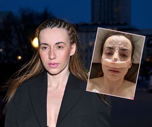 Marianna Schreiber przeszła poważną operację. Czekała na to 15 lat