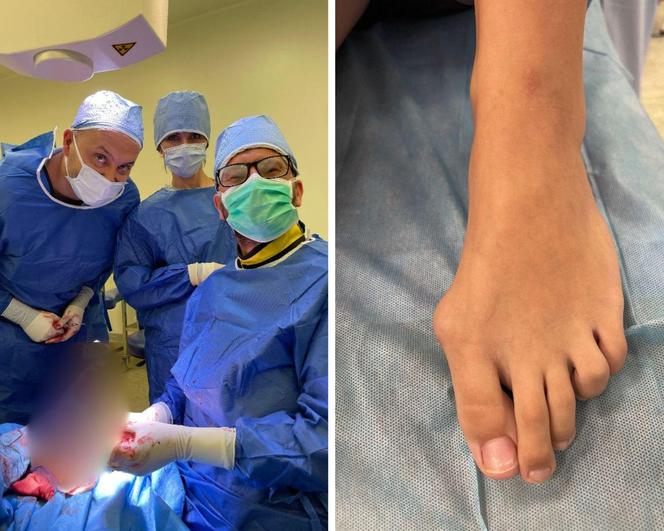 Chorzów. Innowacyjny zabieg u dziecka przeprowadzony po raz pierwszy na Śląsku