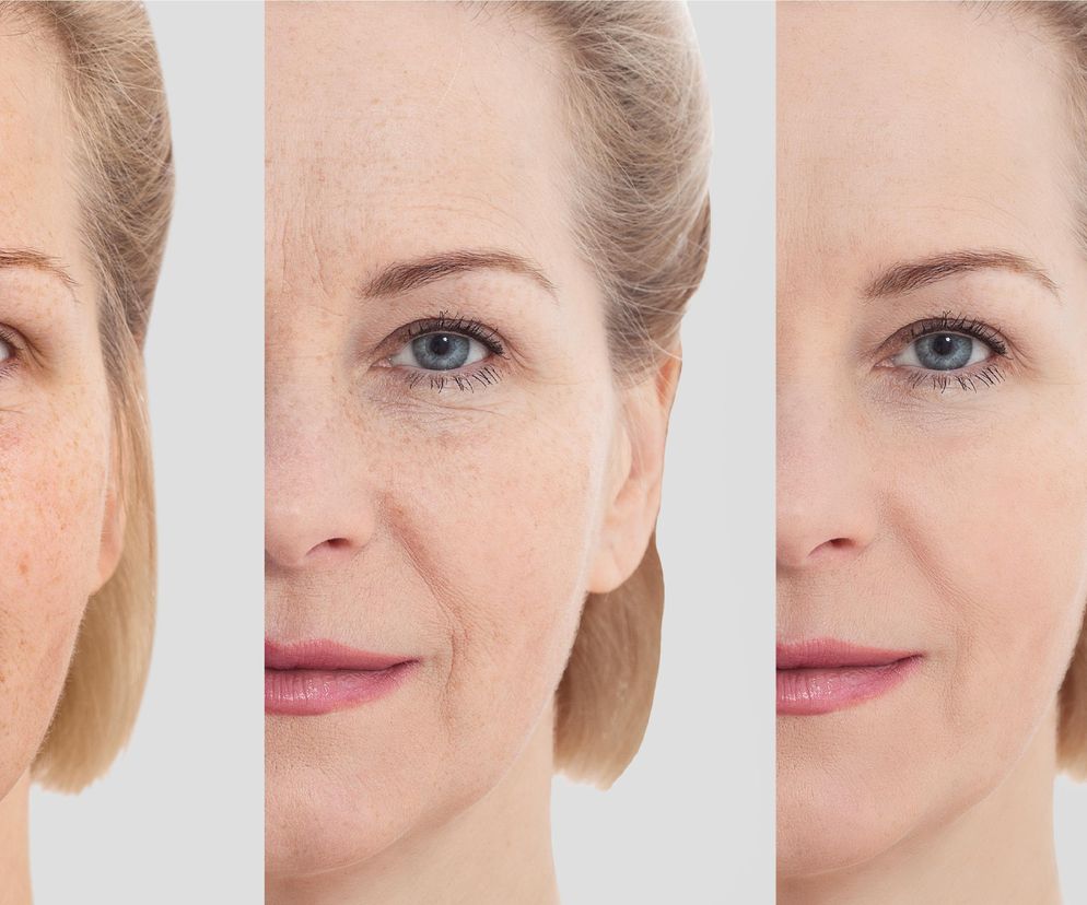 Zmieszaj te dwa składniki z twojej kuchni. Efekt jak po tropokolagenie za 1000 zł