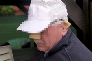 Krwawa przygoda gospodarza z Mazowsza. Krowa Baśka zjadła mu nos