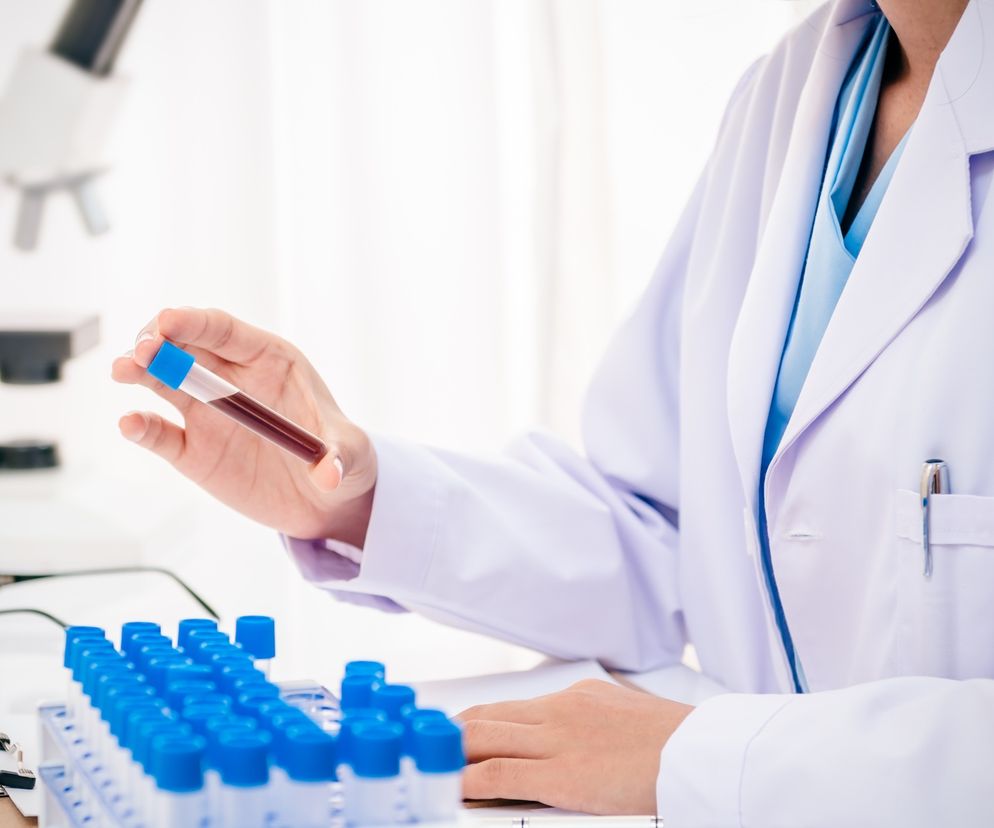 Profil lipidowy: badanie poziomu cholesterolu - frakcji LDL, HDL i trójglicerydów