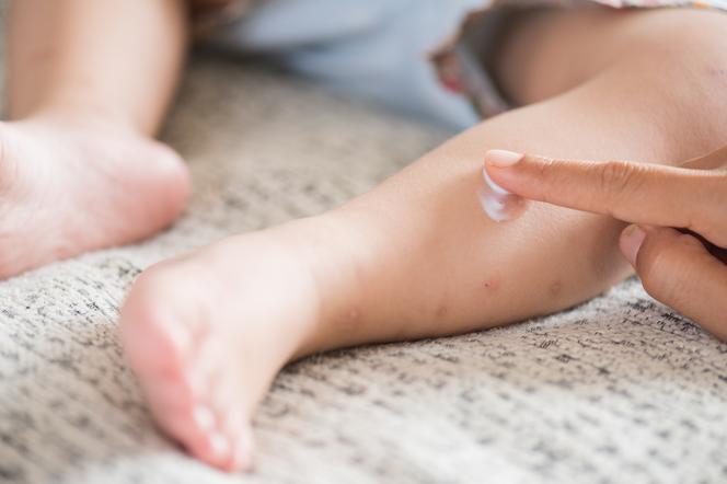 Pielęgnacja dziecka z atopowym zapaleniem skóry. Poznaj 12 najważniejszych zasad 